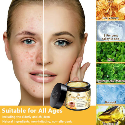 Bee Venam Wart & Mole Removel Cream