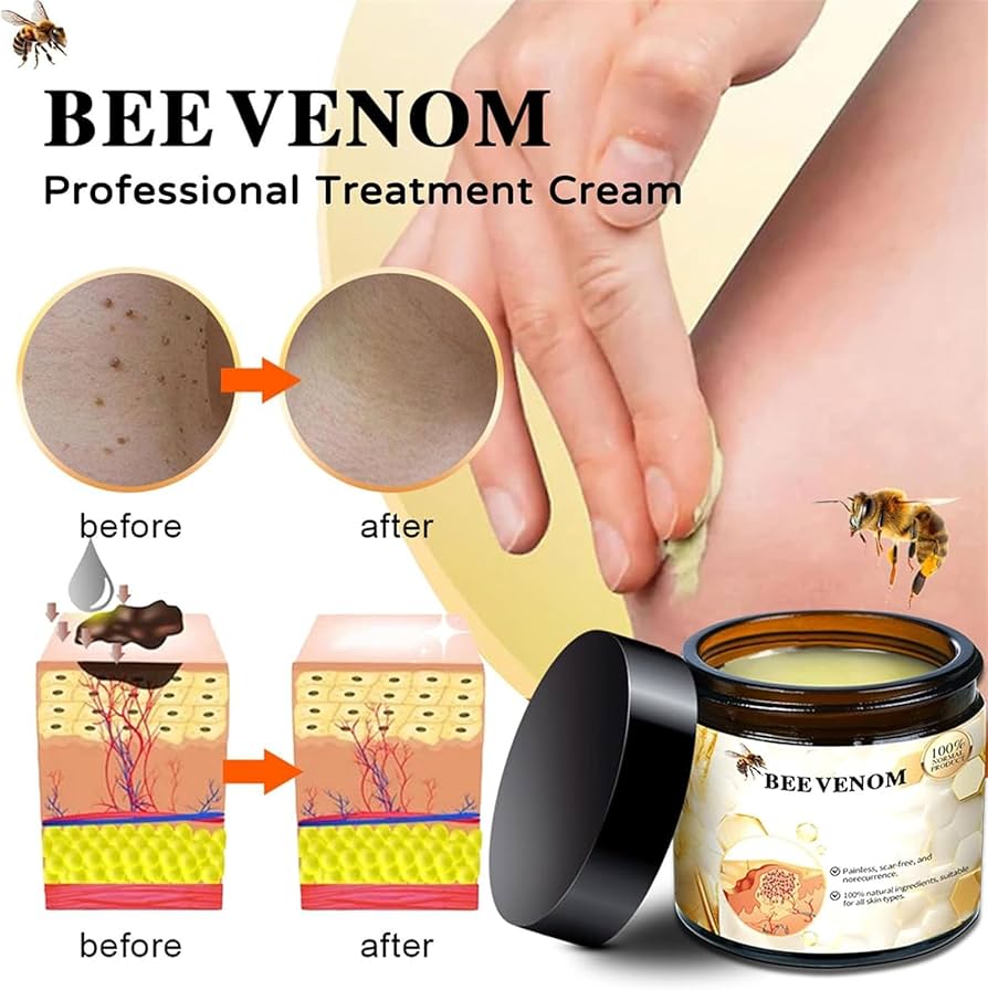 Bee Venam Wart & Mole Removel Cream